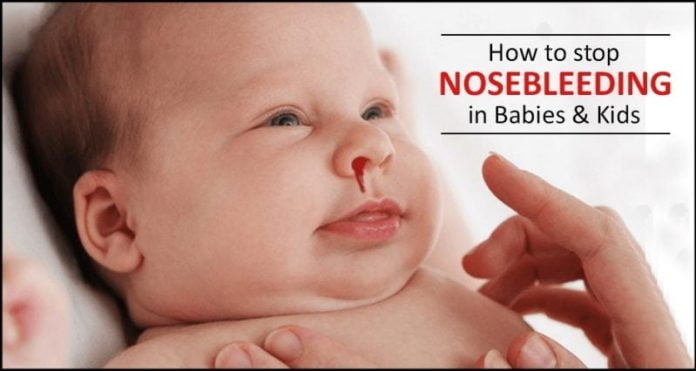 Nosebleed in Babies